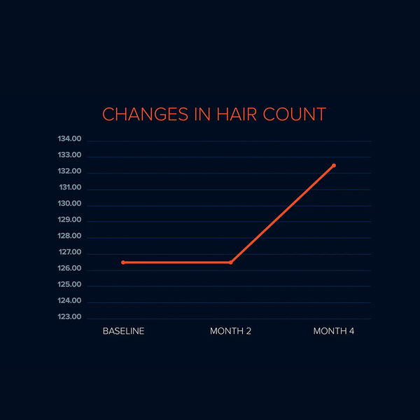 FOLIGAIN Triple Action Complete Formula For Thinning Hair For Men 10% Trioxidil - FOLIGAIN NEW ZEALAND