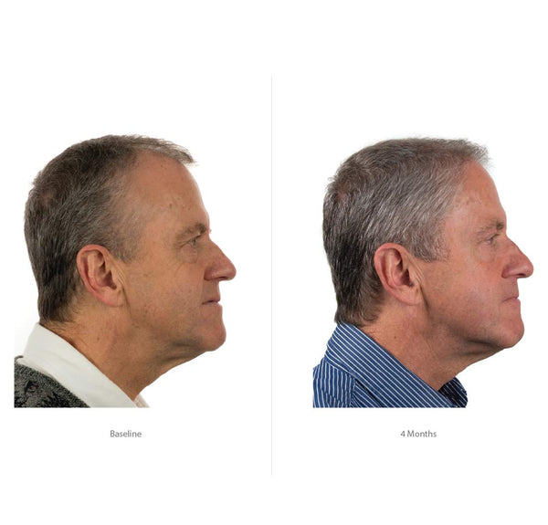 FOLIGAIN Triple Action Shampoo For Thinning Hair For Men with 2% Trioxidil 473ml - FOLIGAIN NEW ZEALAND